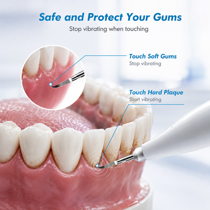 Ultrasonic Tooth Cleaner - For Visible Buildup and Surface Stains